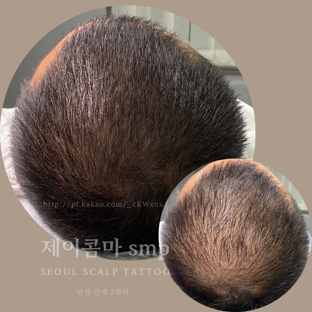 제이콤마