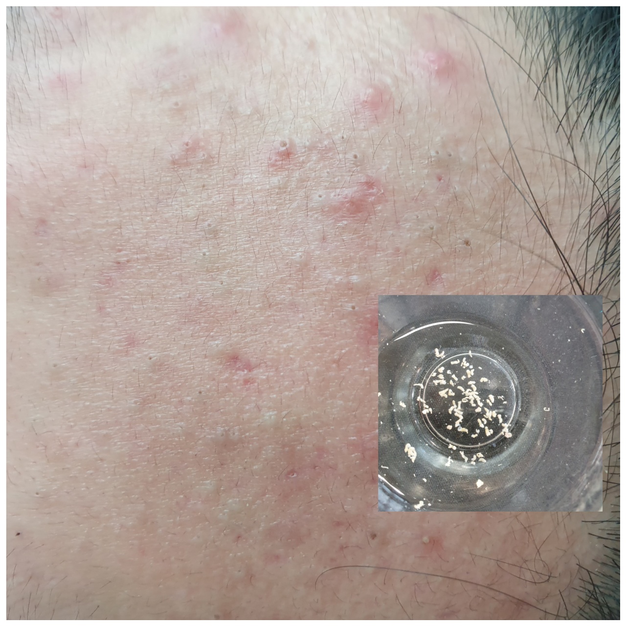 그녀의피부이야기 대표 이미지