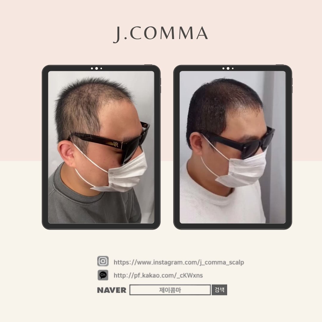 제이콤마
