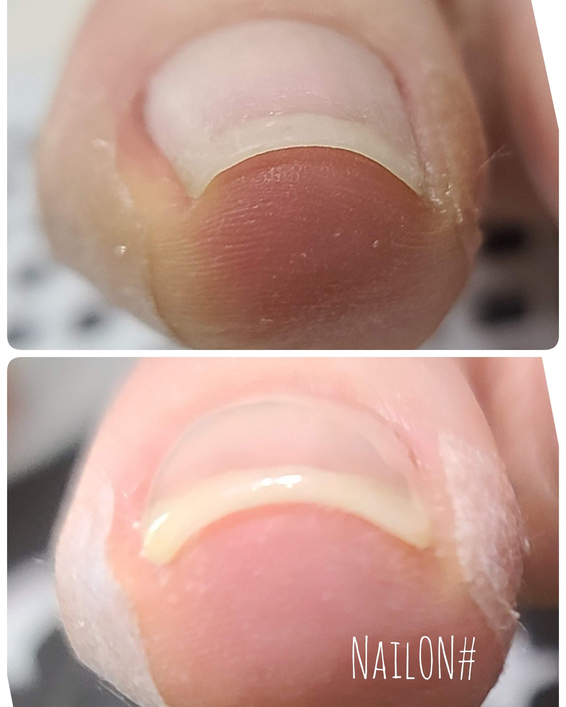 네일온 대표 이미지