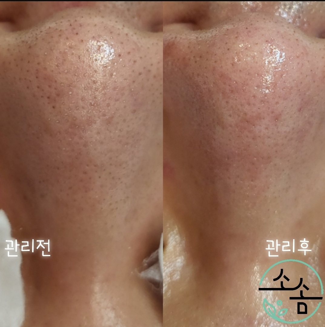 소솜피부관리소 대표 이미지
