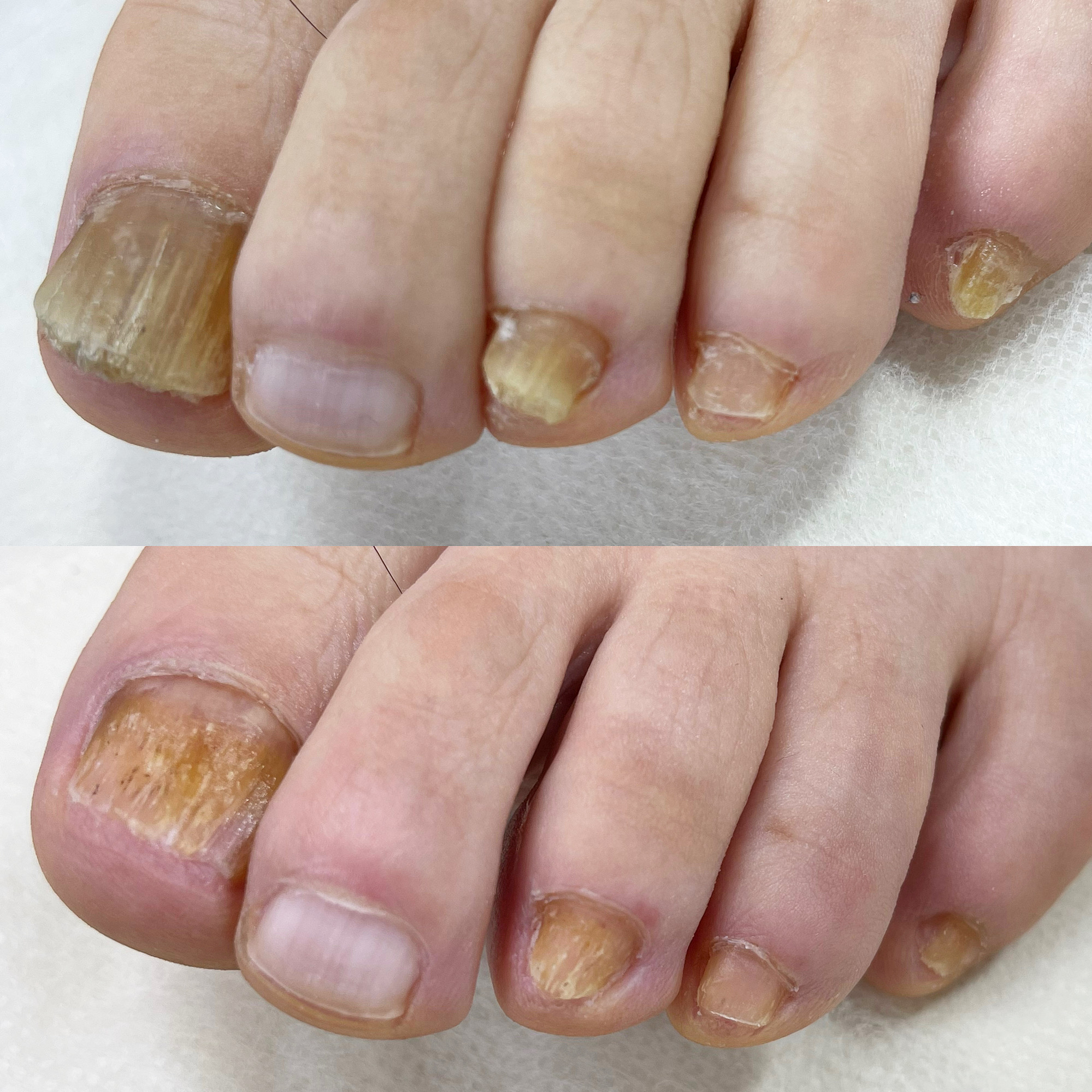 닥터아이티엔 씨유네일 대표 이미지