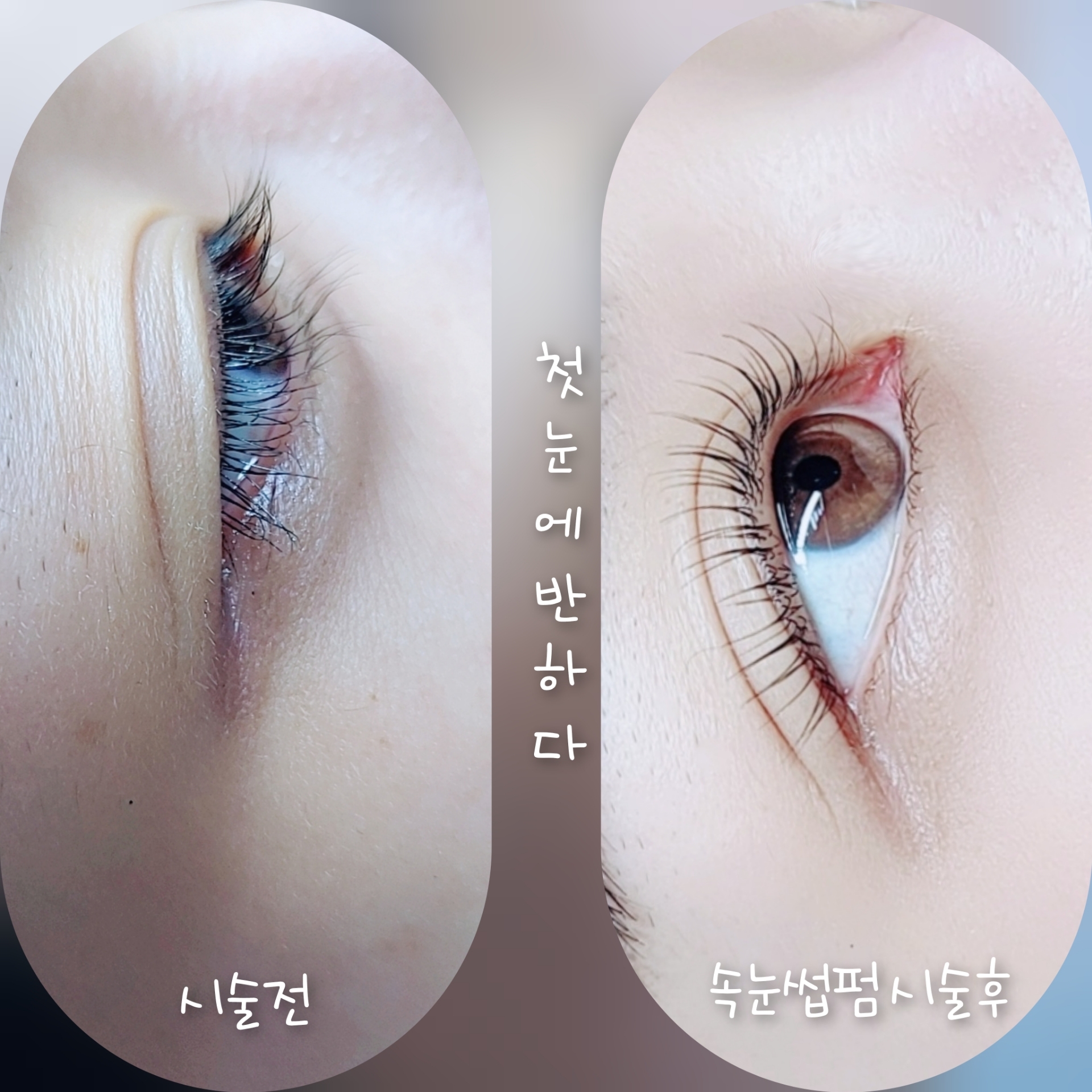 첫눈에 반하다