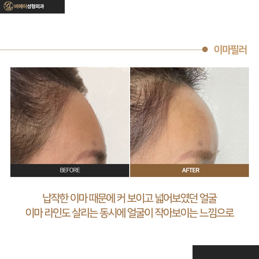 비에이성형외과의원 대표 이미지