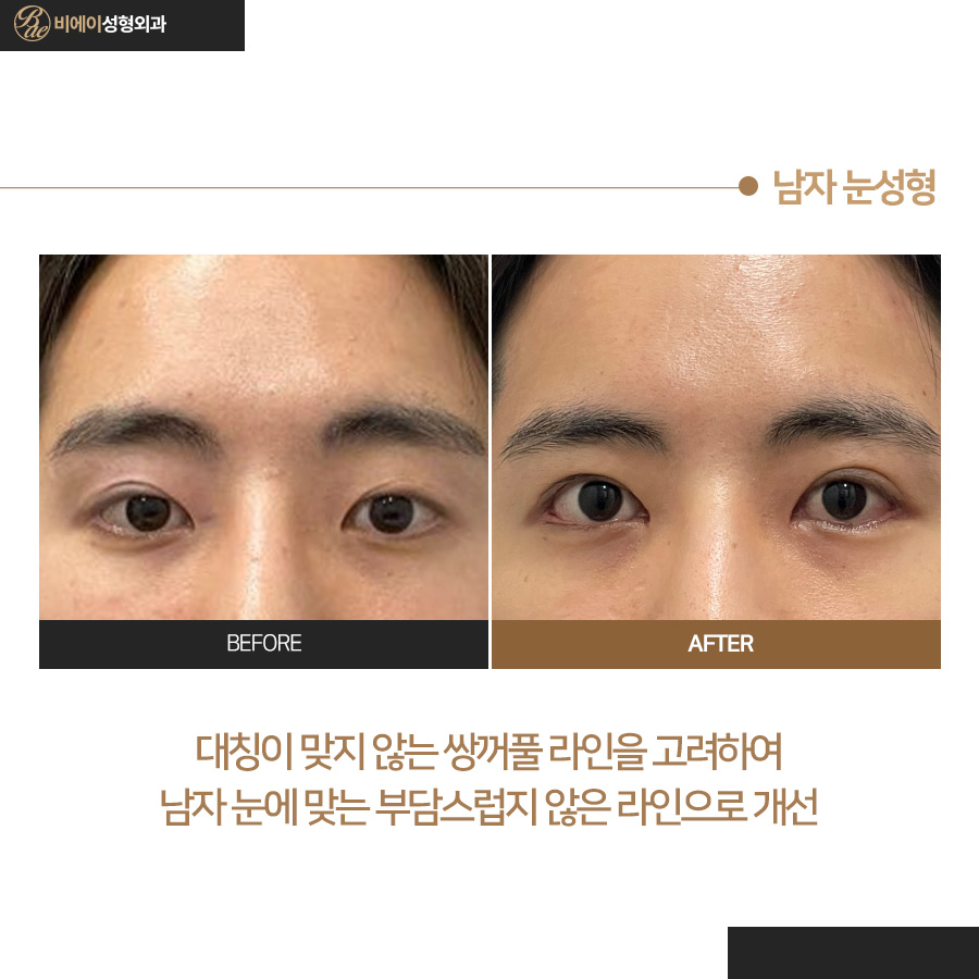 비에이성형외과의원 대표 이미지