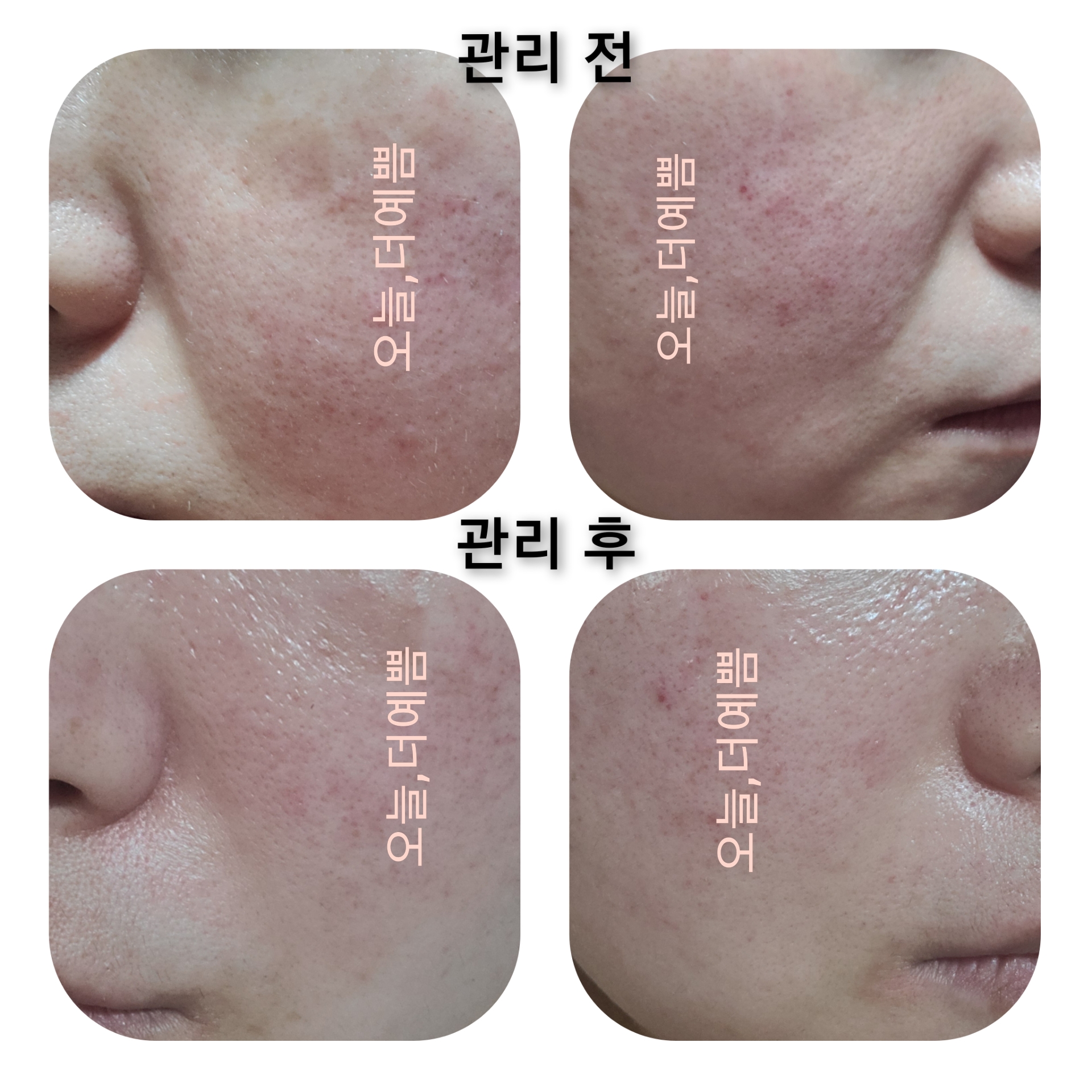 오늘더예쁨뷰티샵