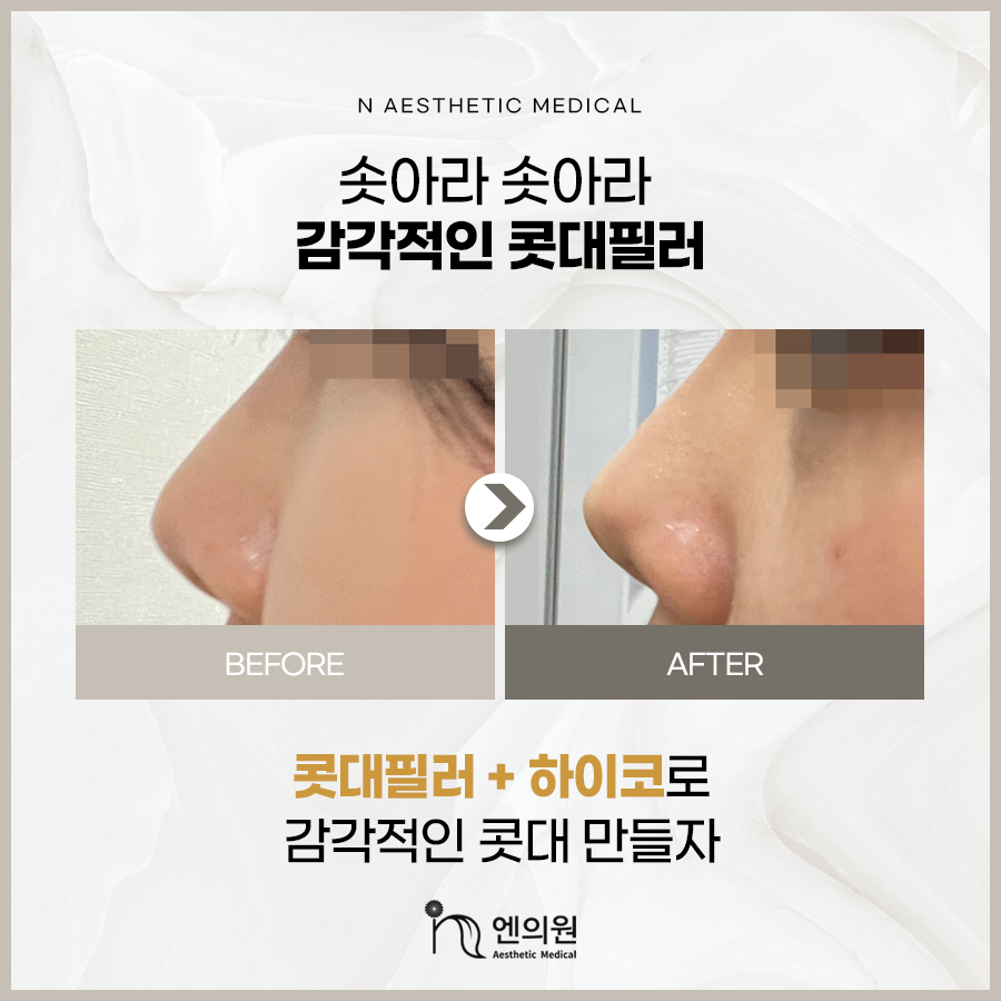 엔의원