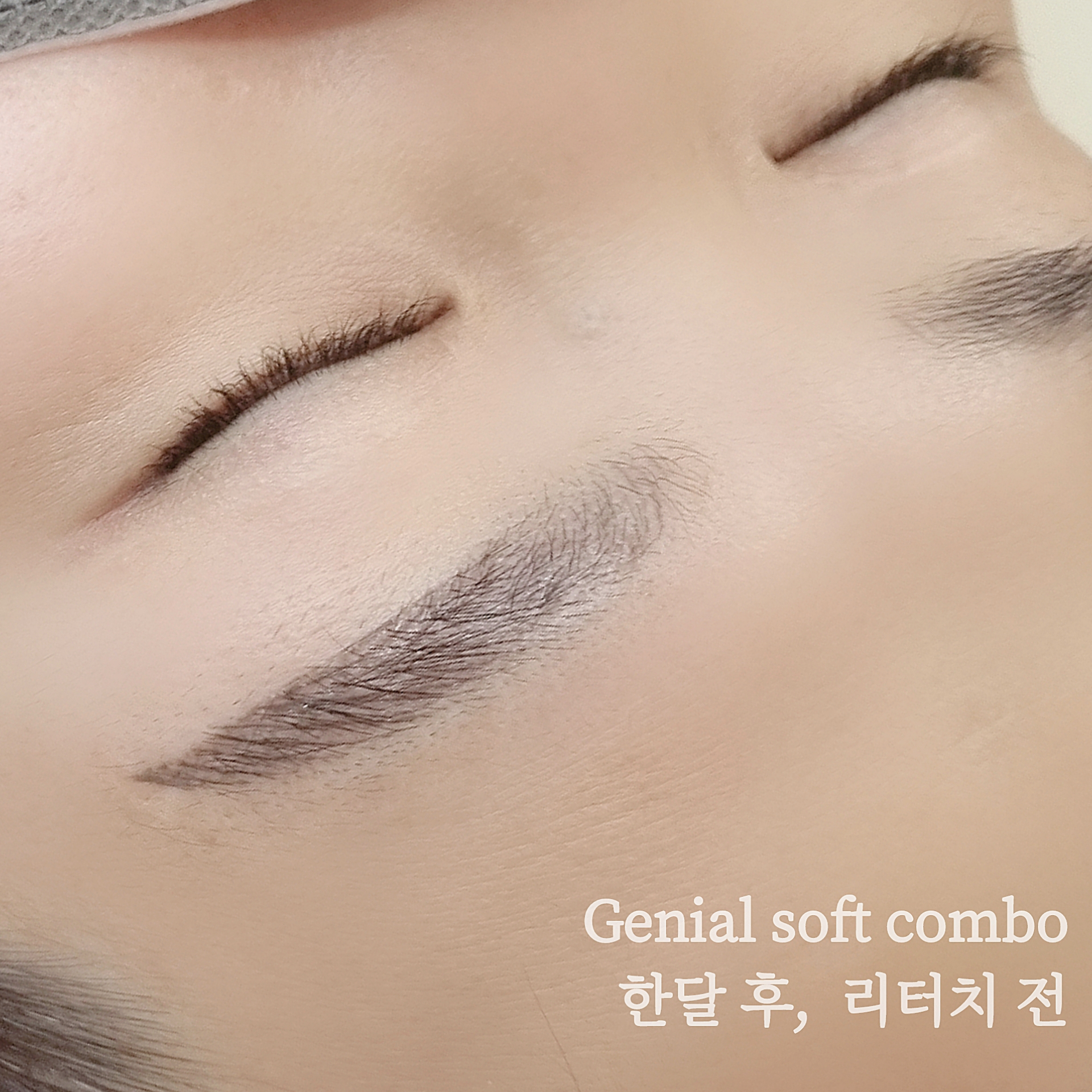 브로우제니아르 양주옥정점