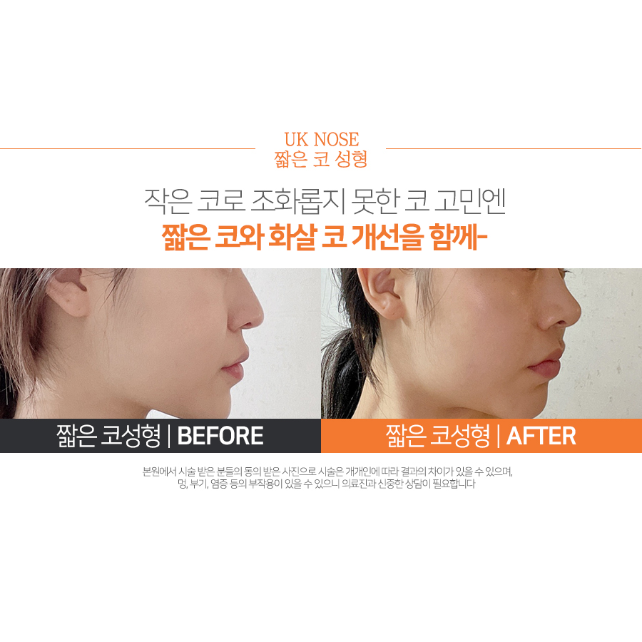 유케이성형외과의원 대표 이미지