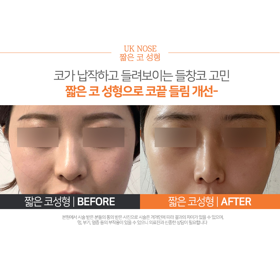 유케이성형외과의원 대표 이미지