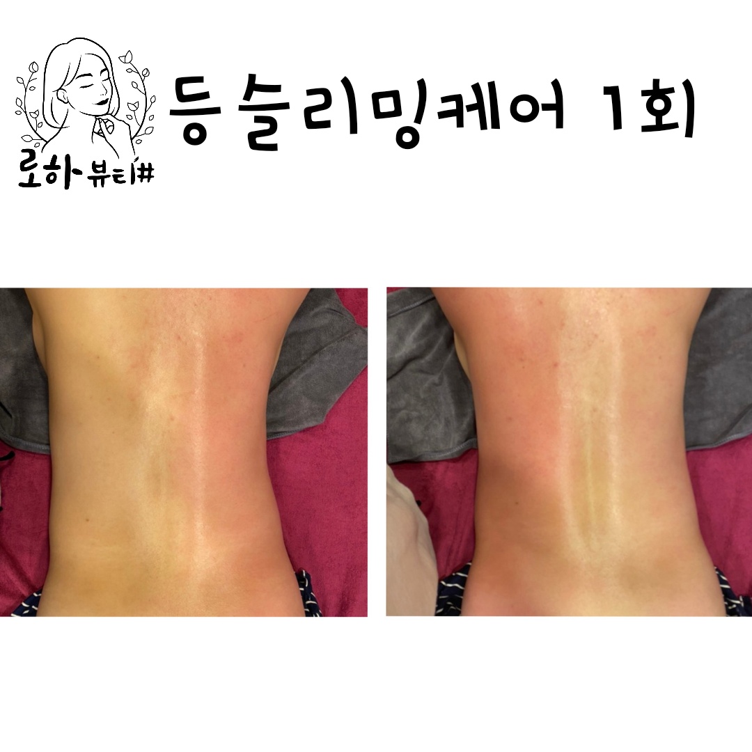 로하뷰티 대표 이미지