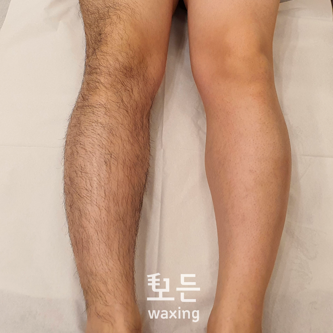 모든왁싱 브라질리언왁싱 대표 이미지