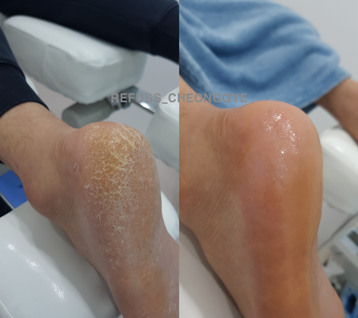 레푸스 청계천점 대표 이미지