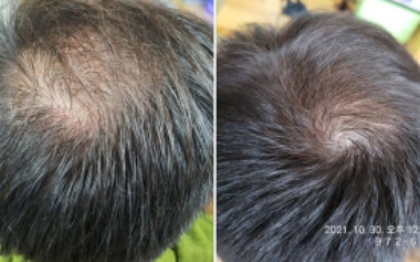 마이모셀 두피센터 CST Healing 대표 이미지