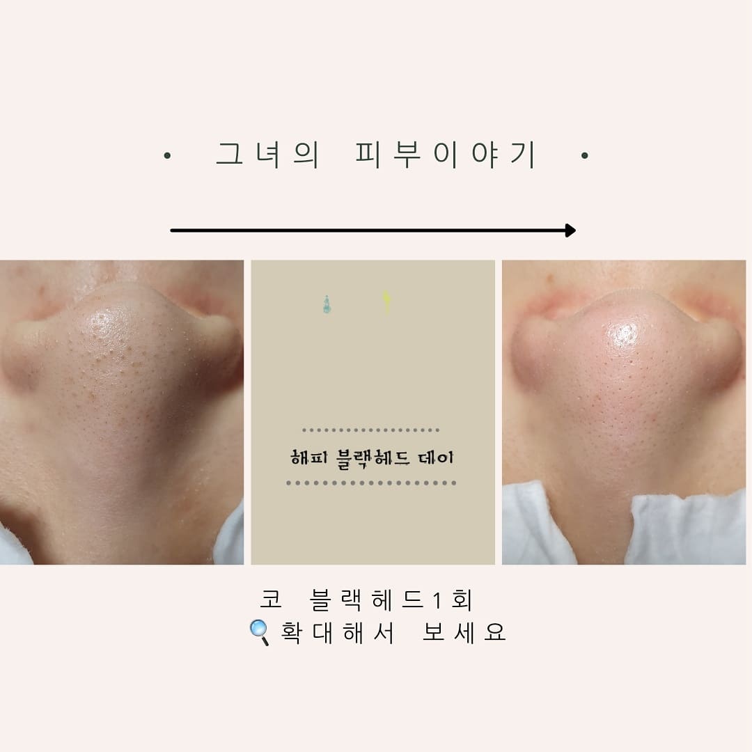 그녀의피부이야기 대표 이미지