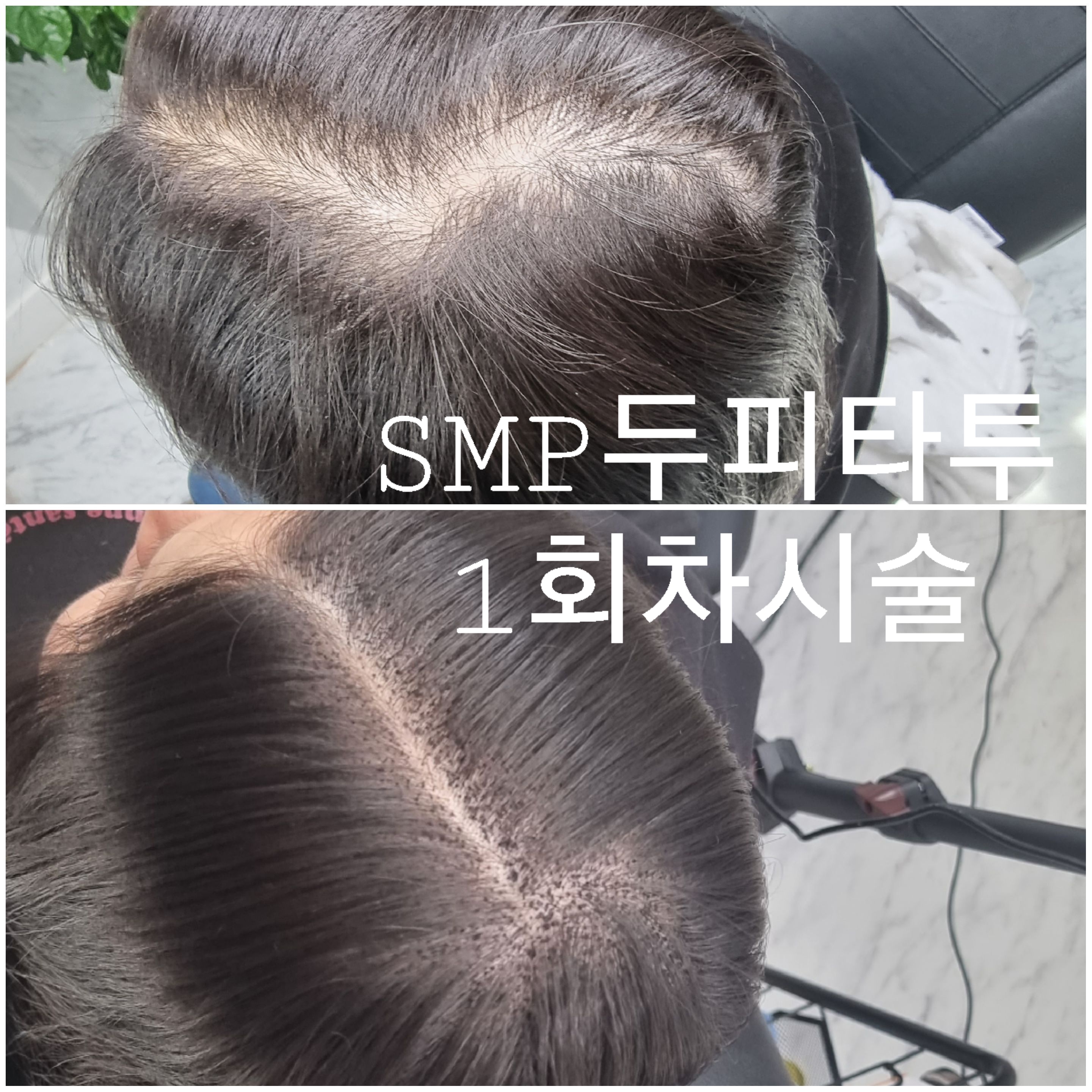 샬롱드에뜨왈