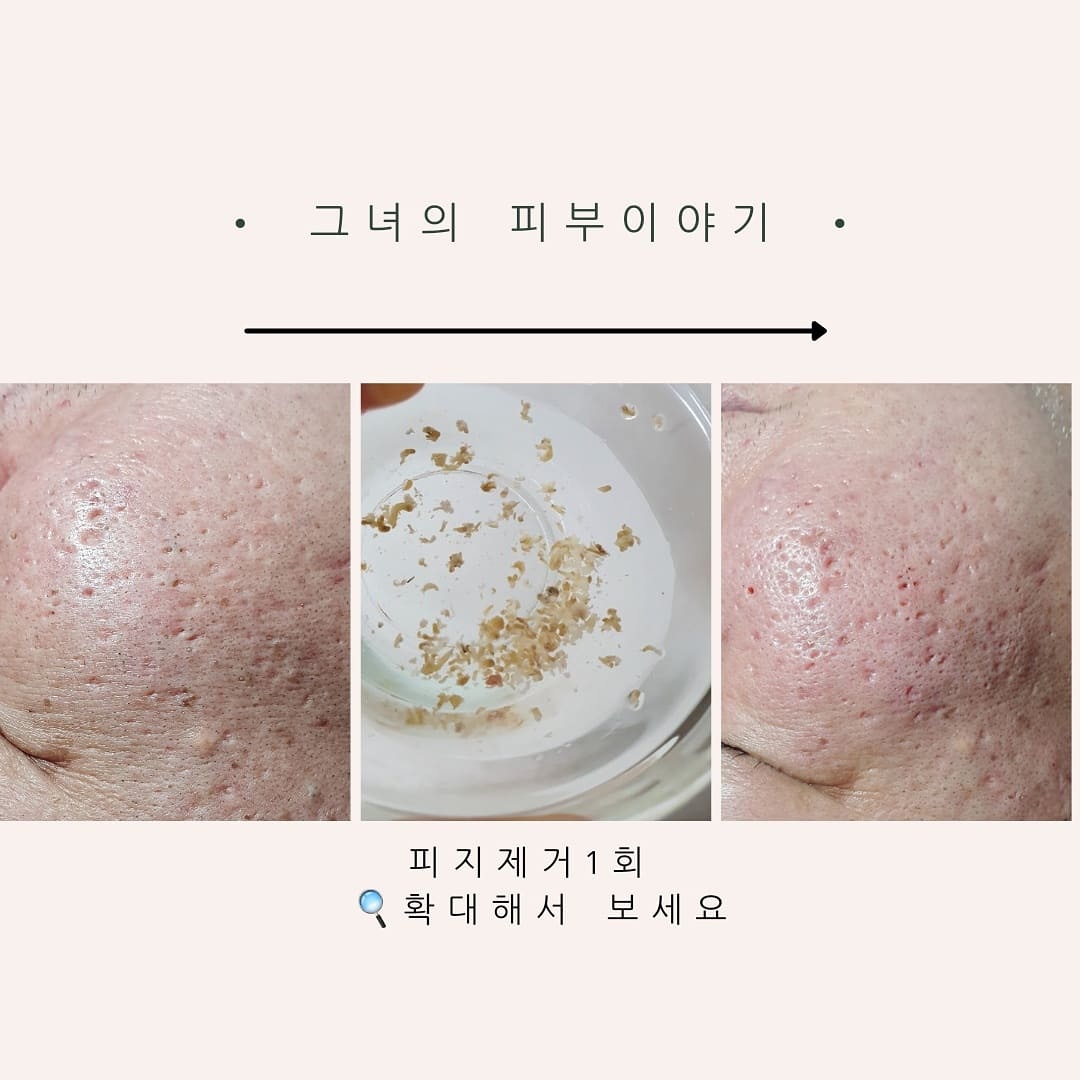 그녀의피부이야기 대표 이미지