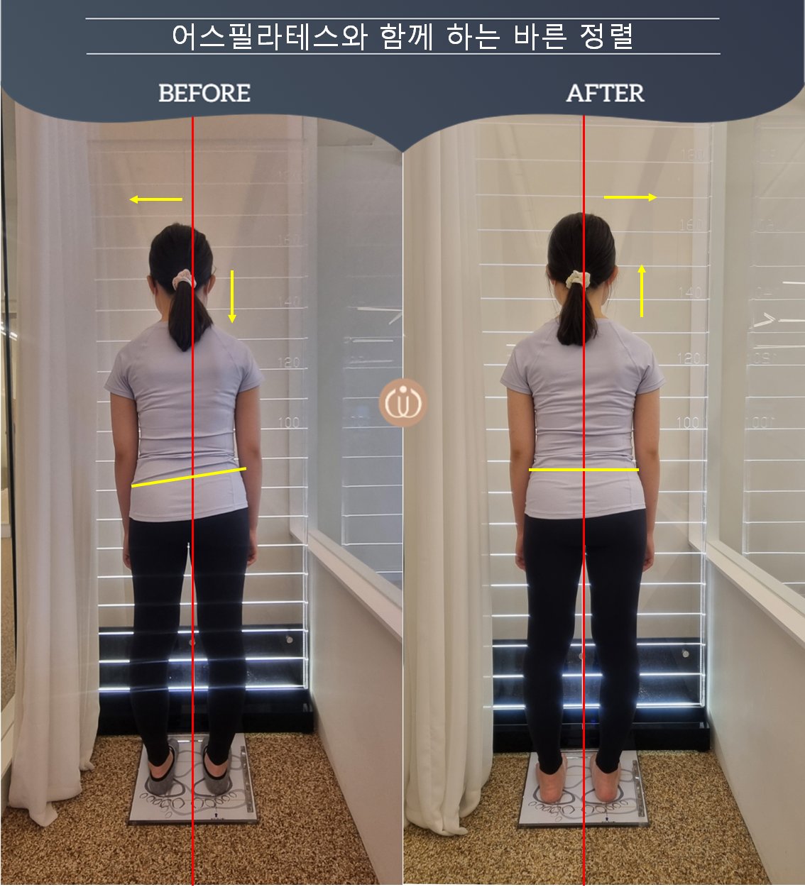 어스필라테스 매곡점 대표 이미지 (비포 에프터 사진)