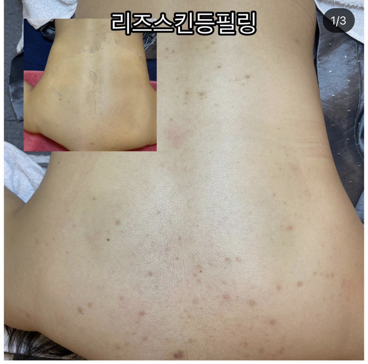 리즈스킨 대표 이미지
