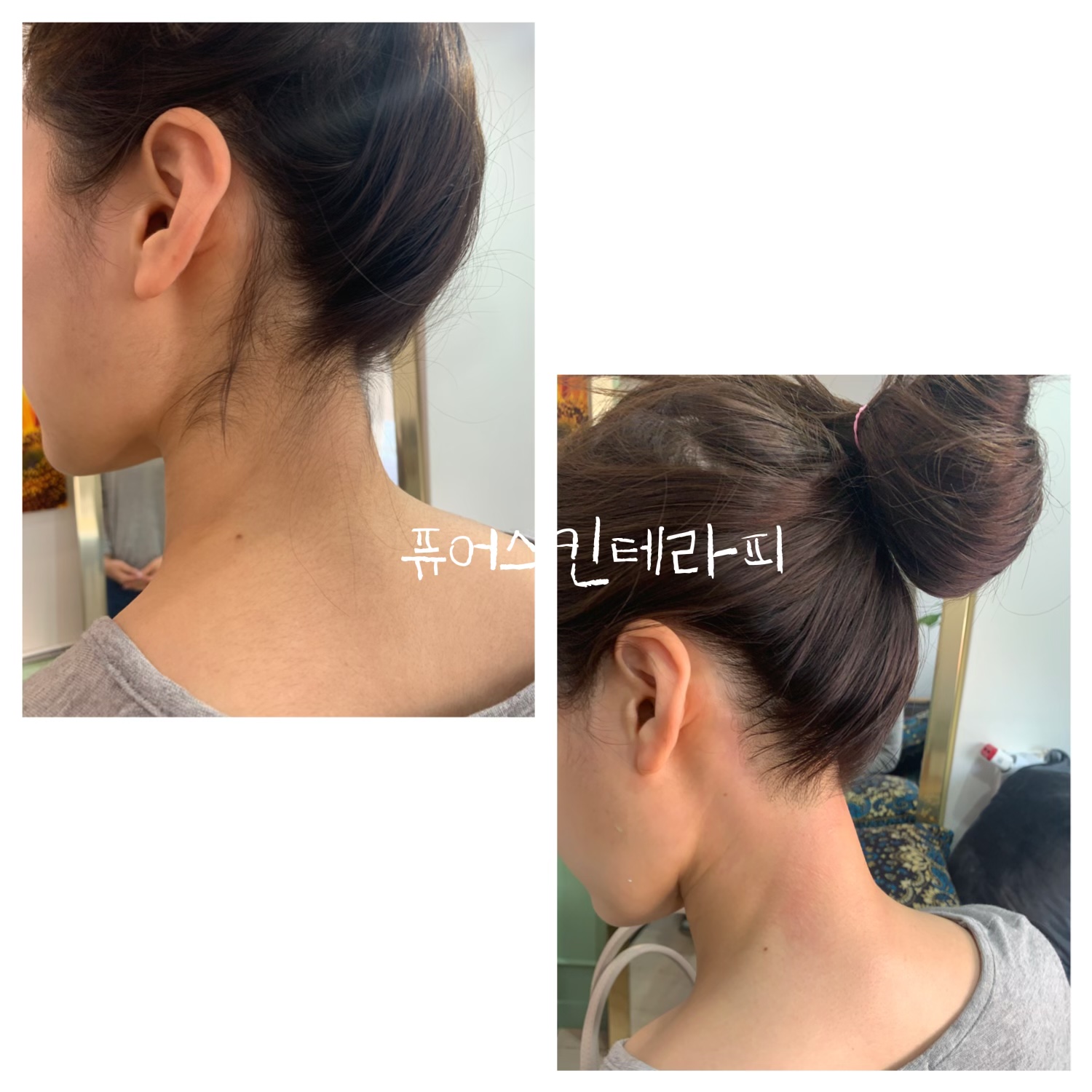 퓨어스킨테라피