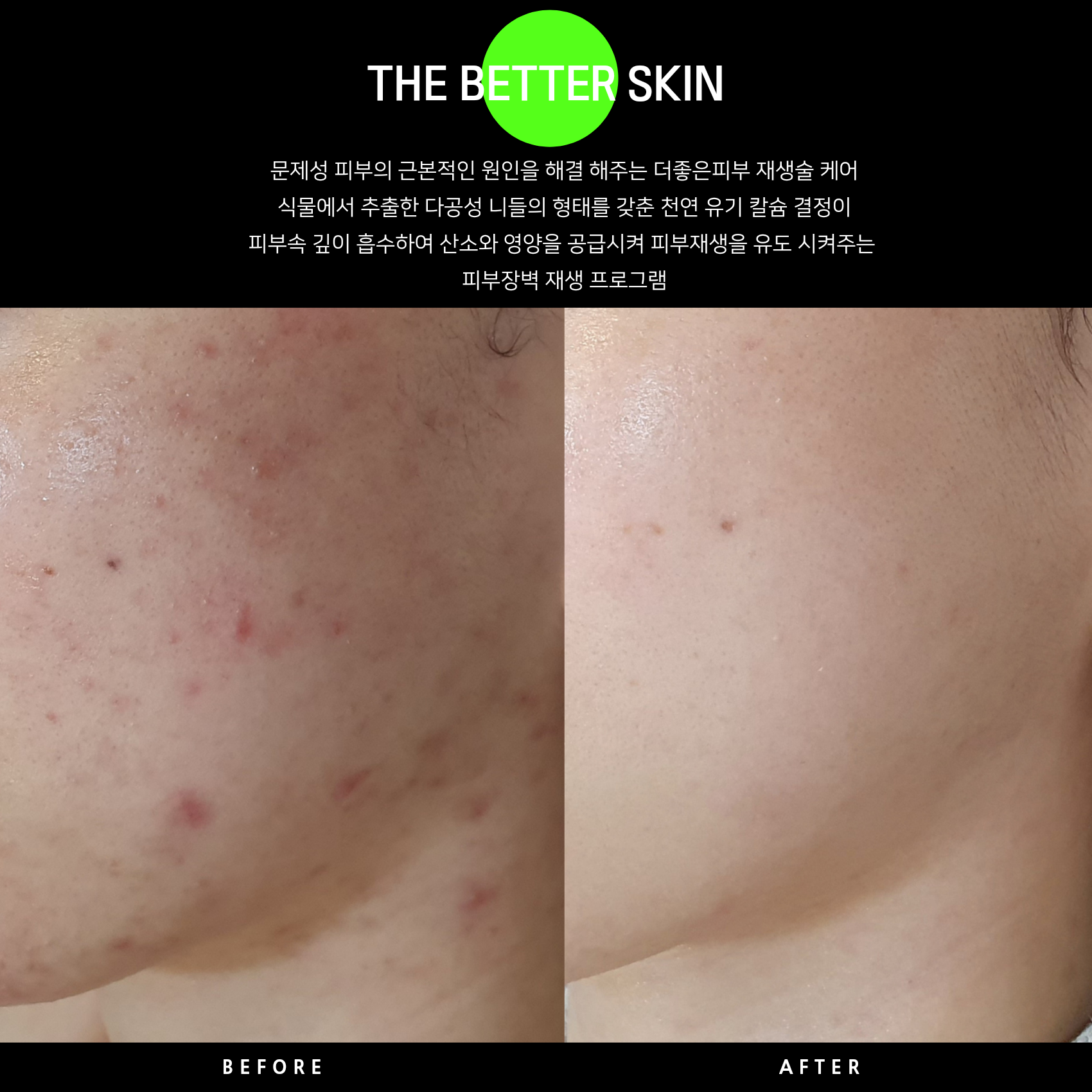 더좋은피부