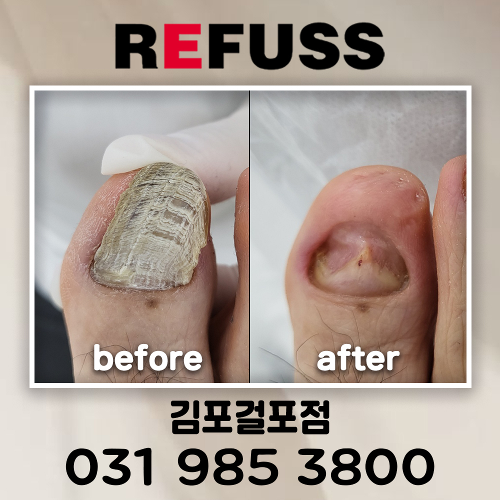 레푸스 김포걸포점