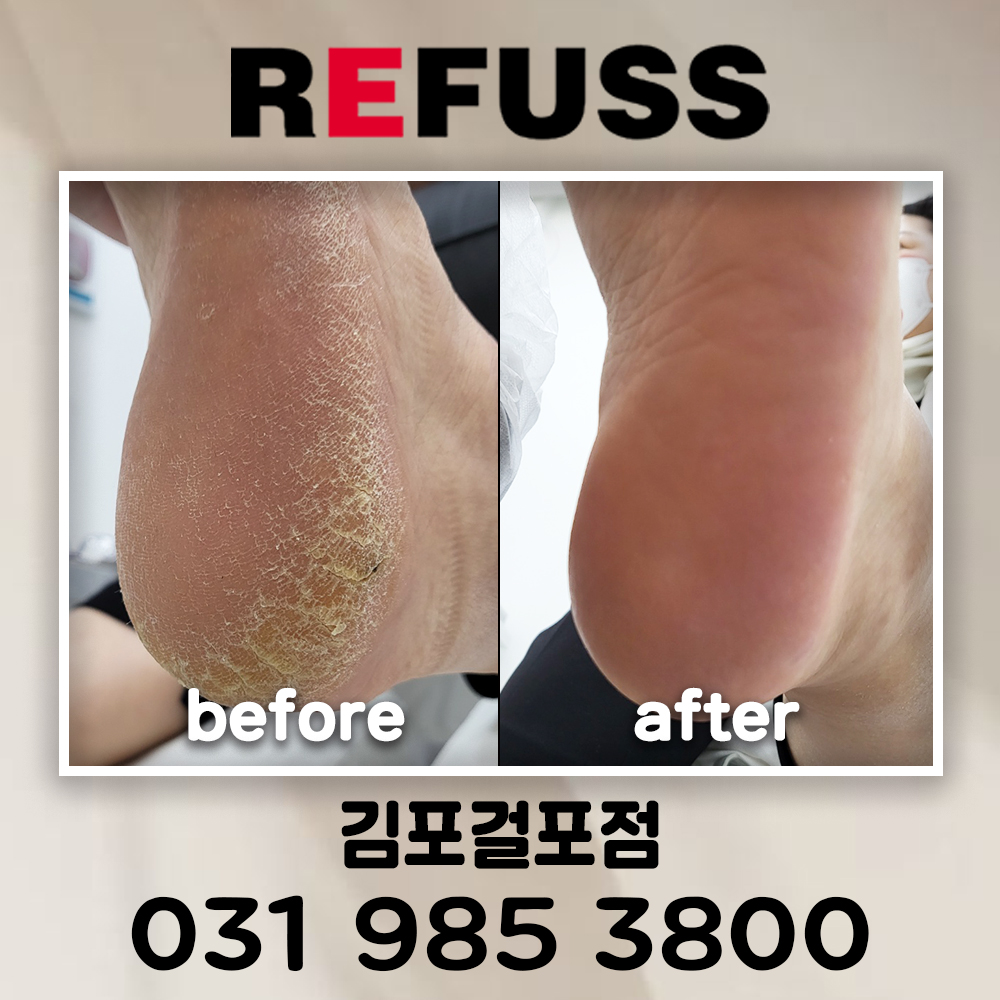 레푸스 김포걸포점