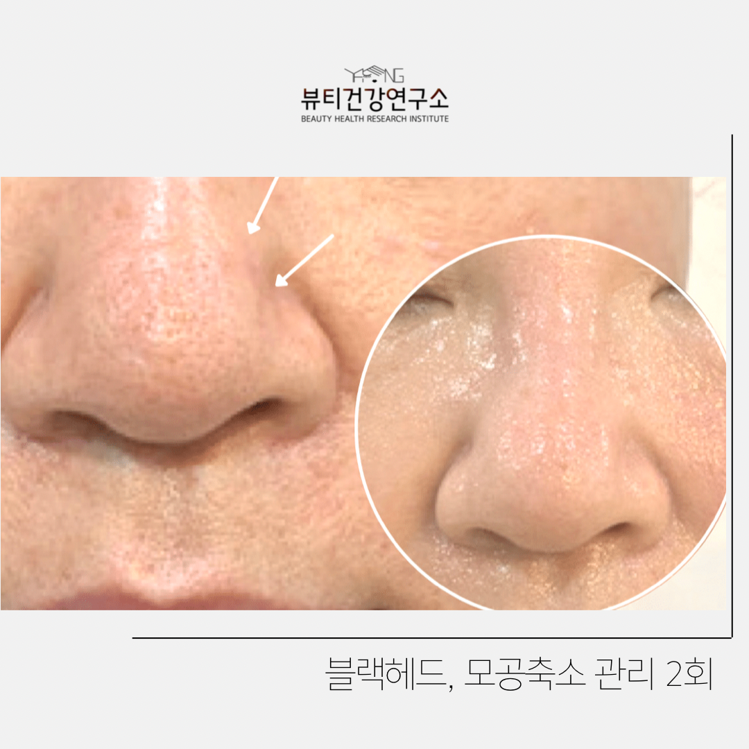 뷰티건강연구소 강남 신사본점