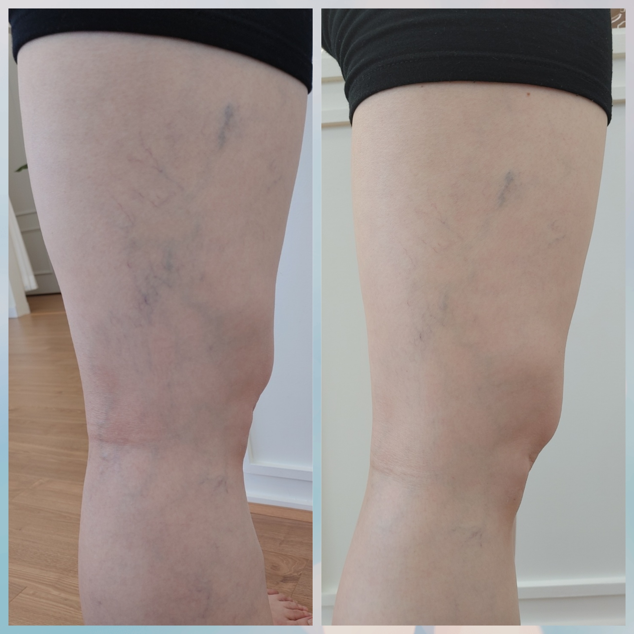 시온필라테스 대표 이미지