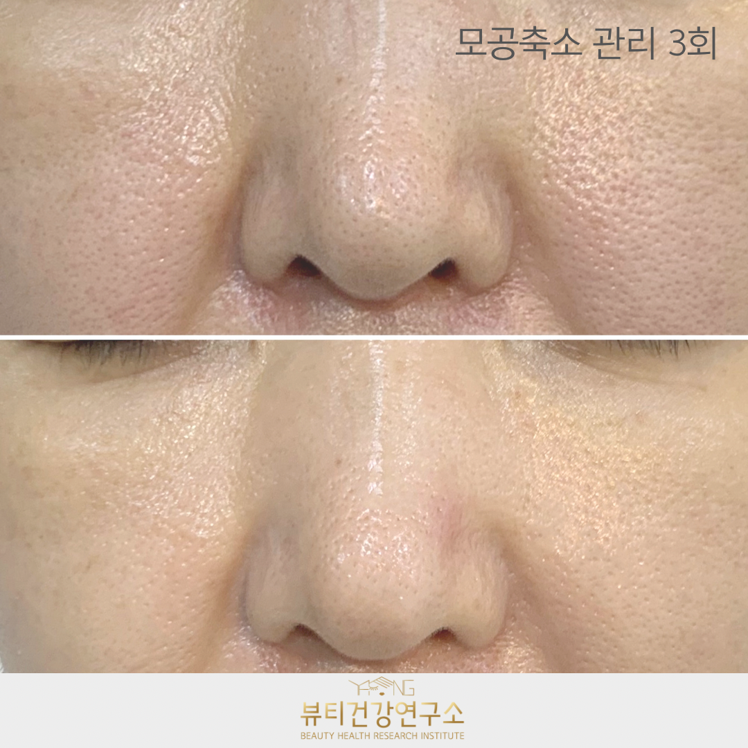 뷰티건강연구소 강남 신사본점 대표 이미지