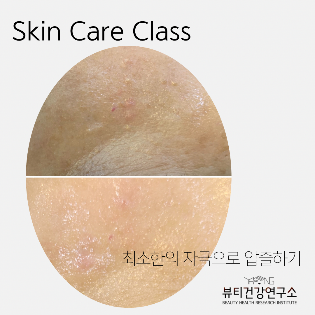 뷰티건강연구소 강남 신사본점