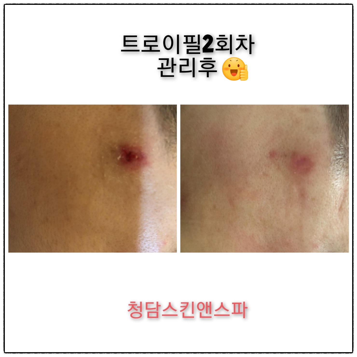 청담스킨앤스파