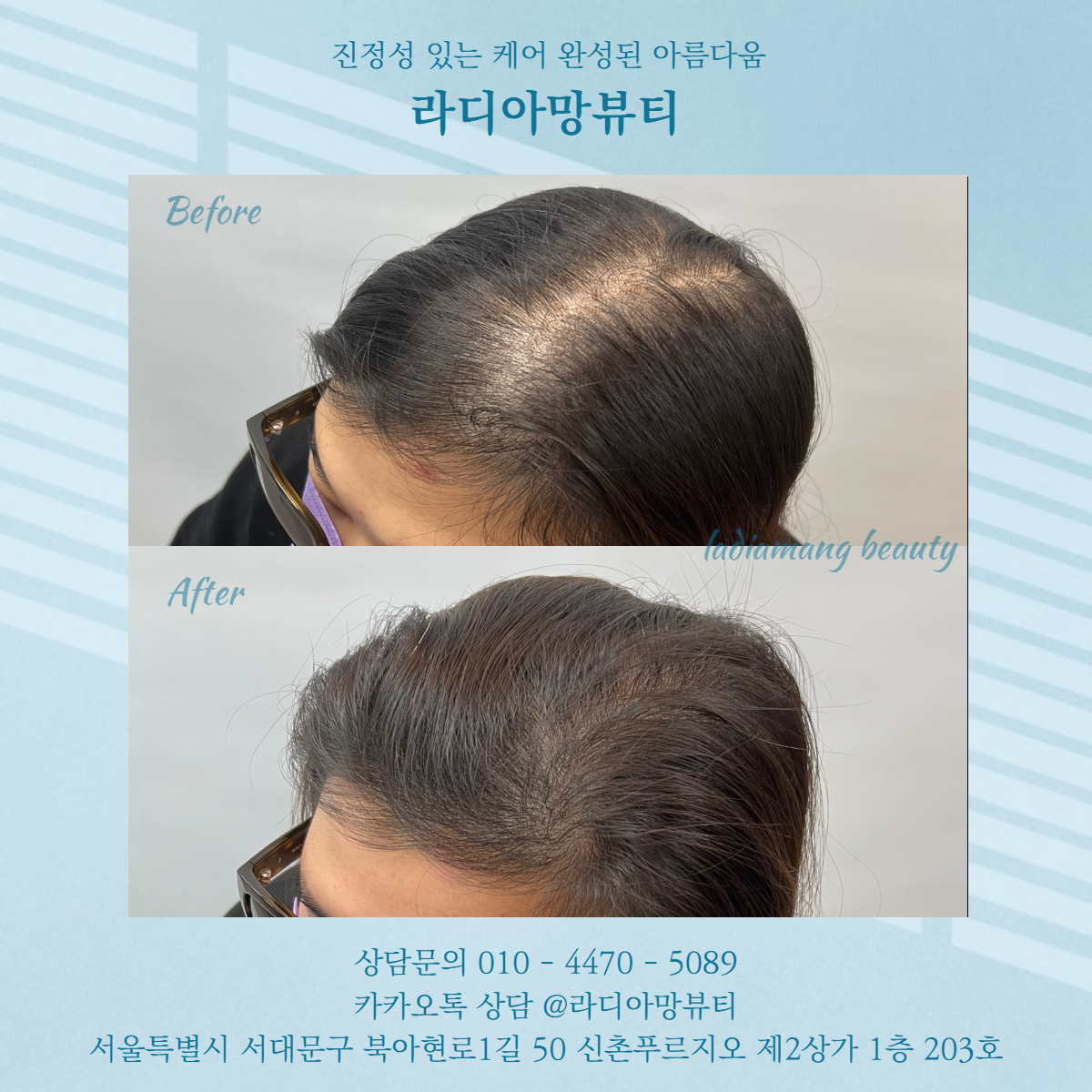 라디아망뷰티 대표 이미지