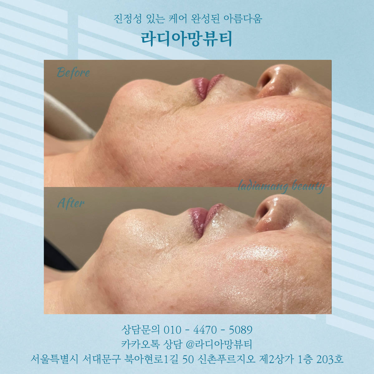 라디아망뷰티 대표 이미지