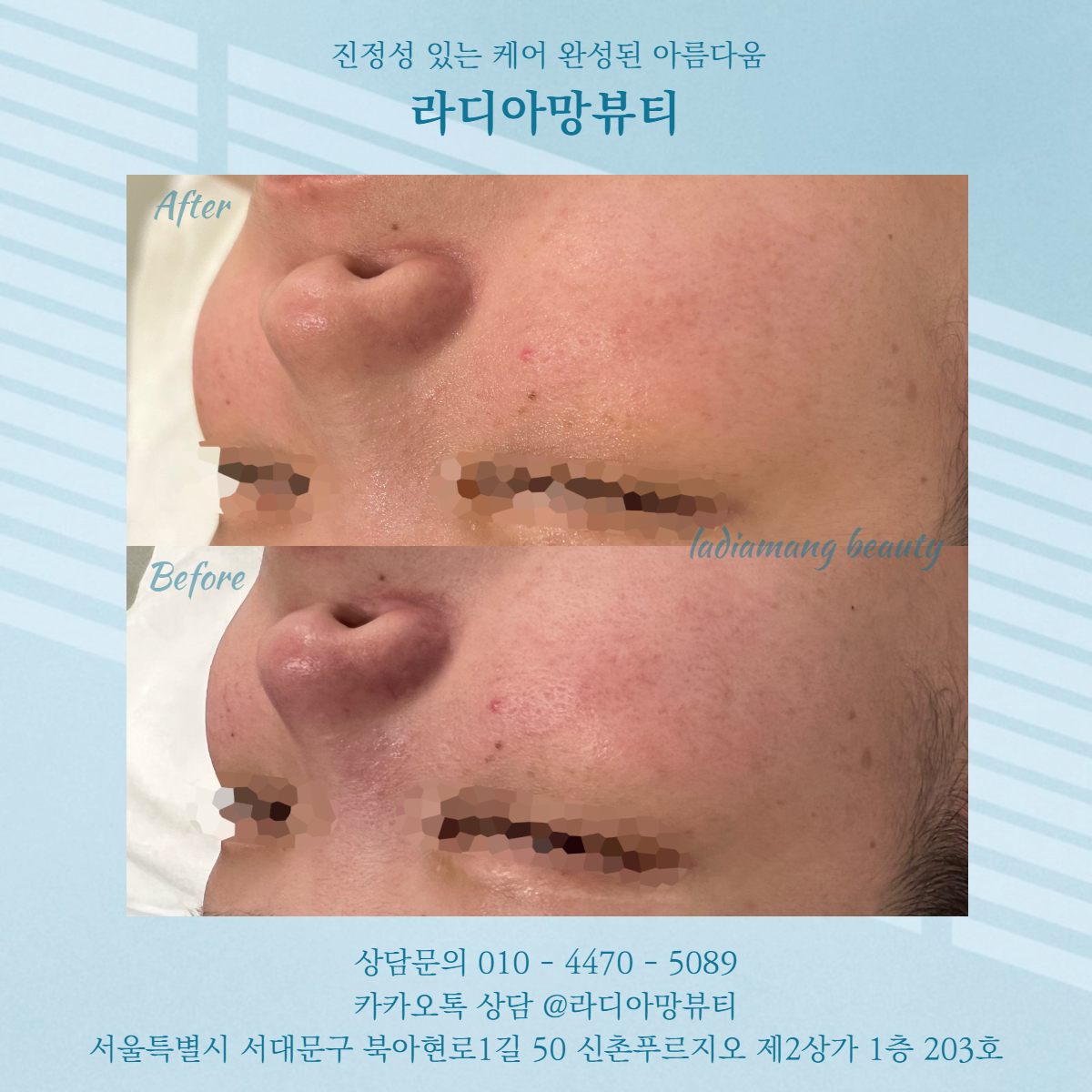 라디아망뷰티 대표 이미지