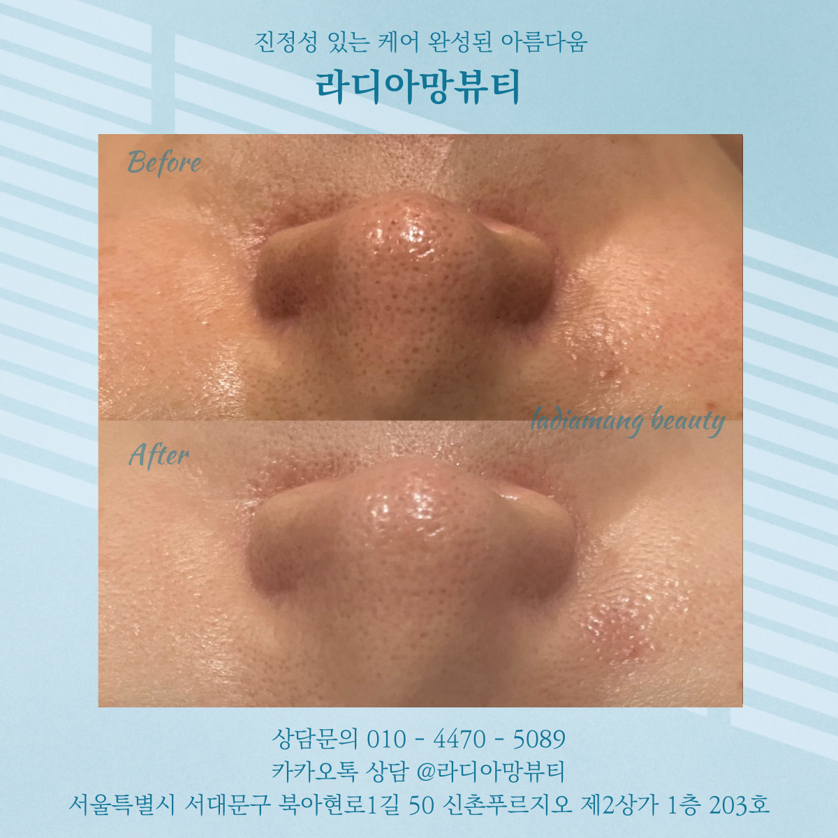 라디아망뷰티 photo 8