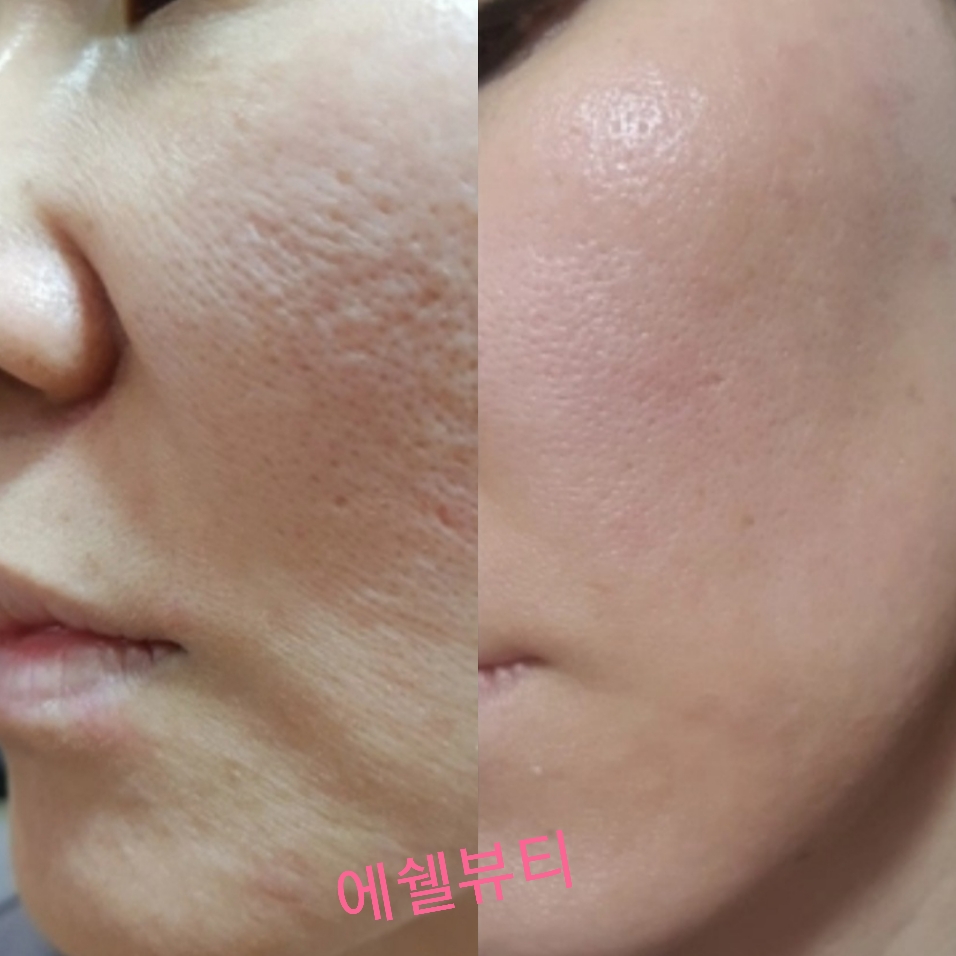 에쉘뷰티 대표 이미지