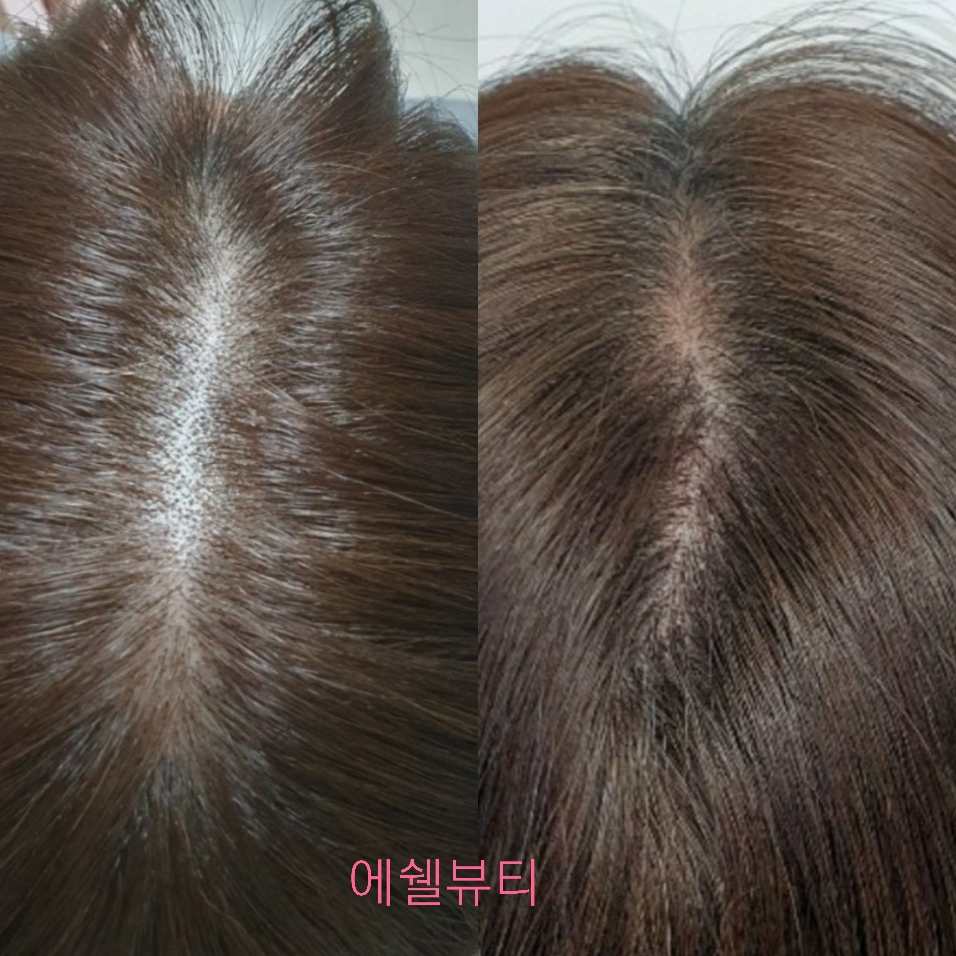 에쉘뷰티 대표 이미지