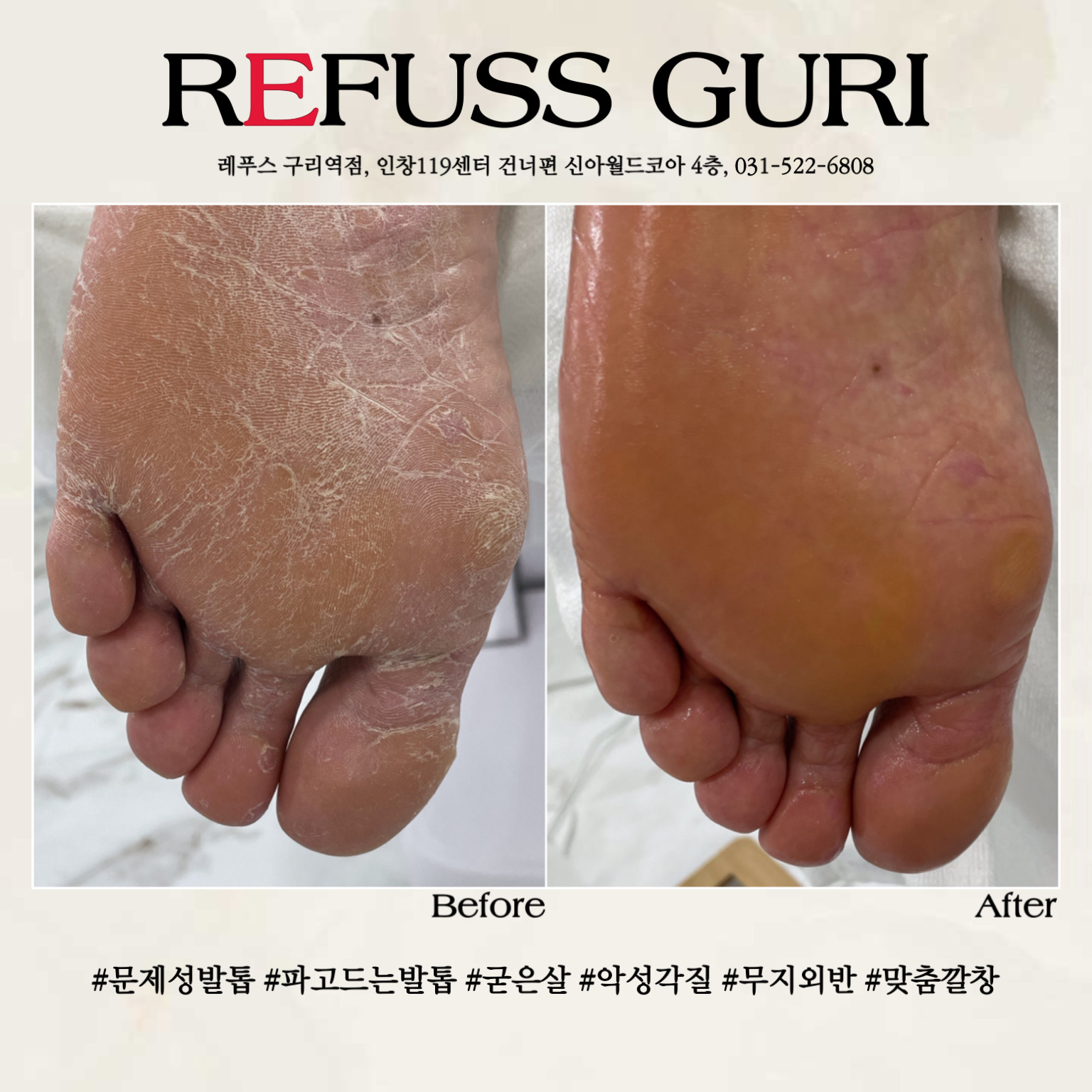 레푸스 구리역점