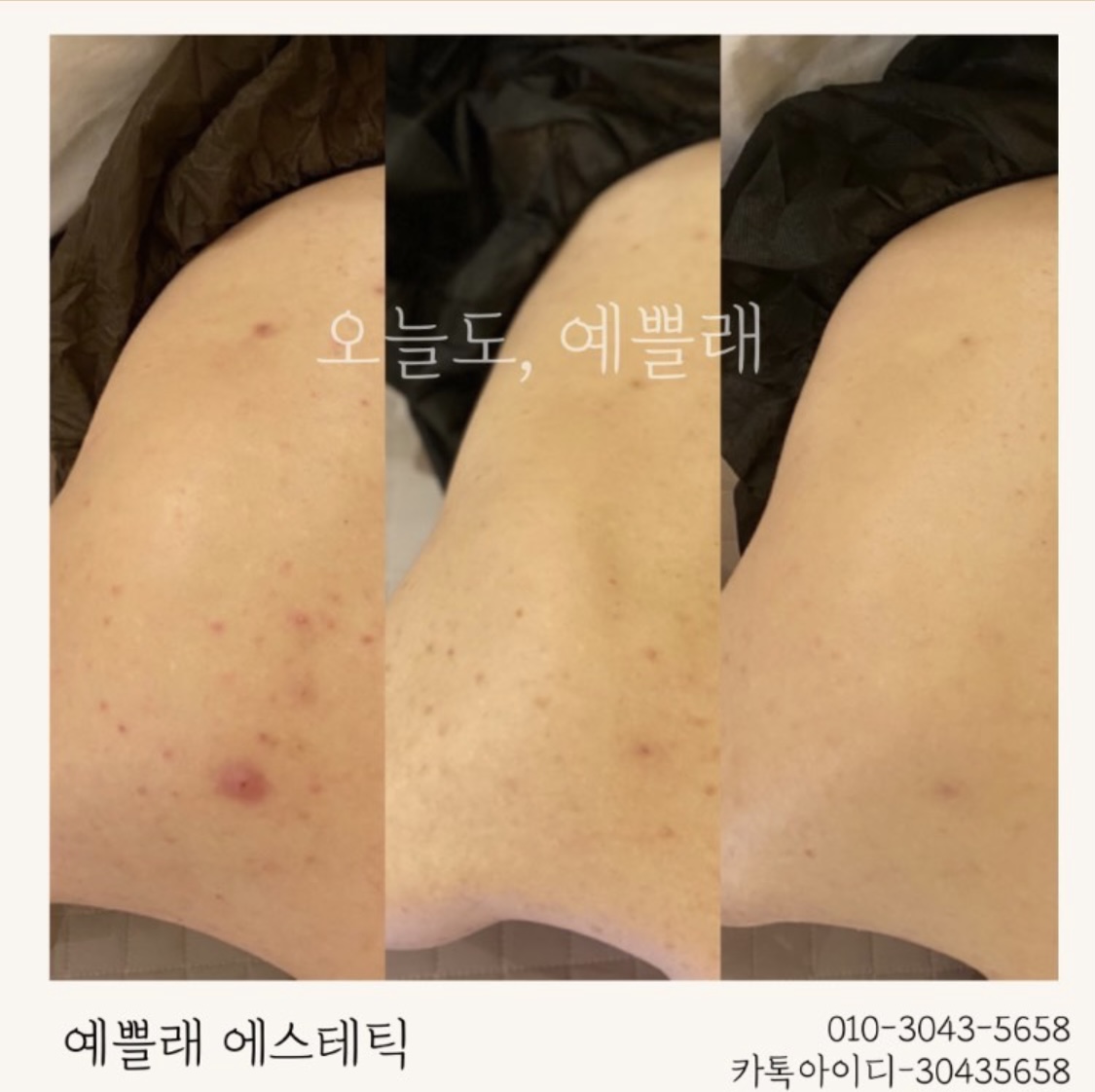 예쁠래 에스테틱