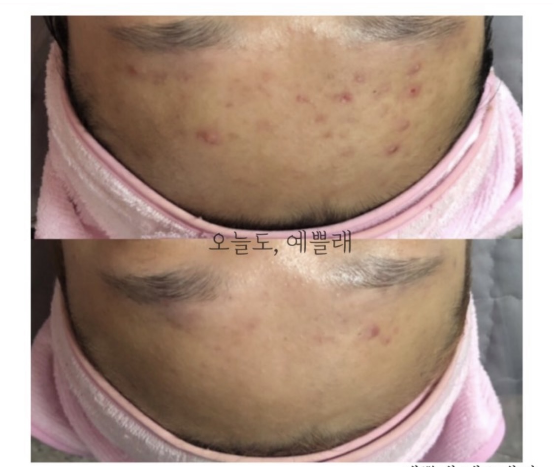 예쁠래 에스테틱