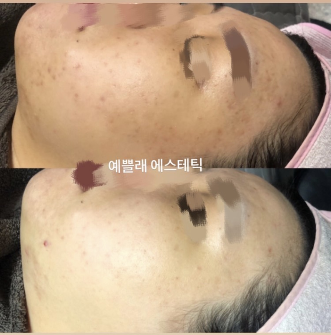 예쁠래 에스테틱