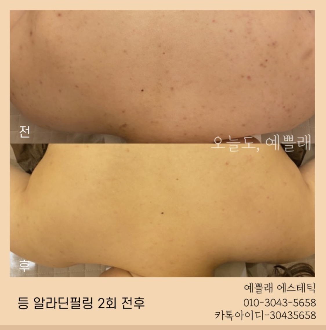 예쁠래 에스테틱