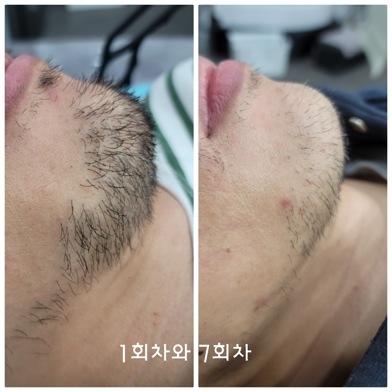 피치왁싱