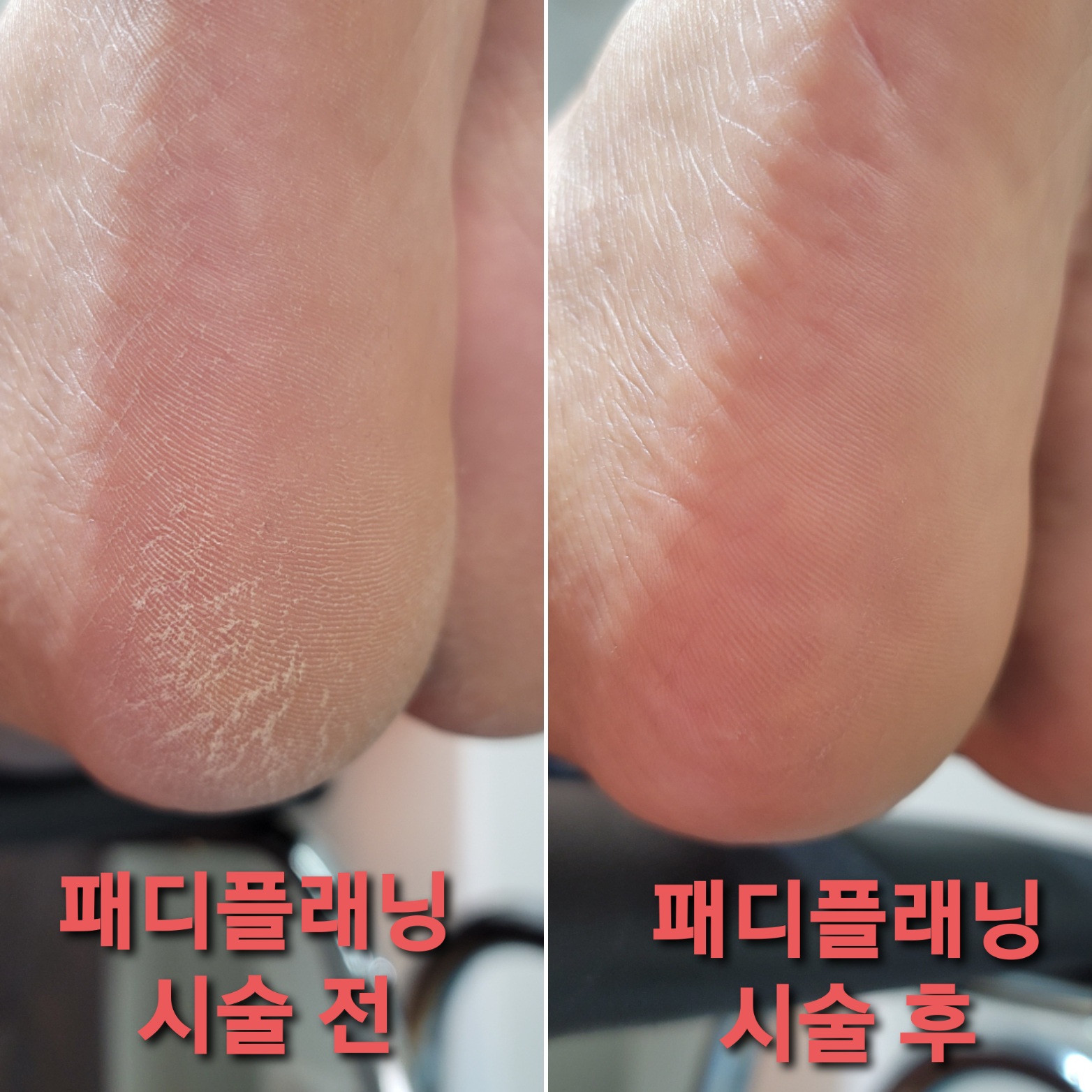 오늘도예쁨가득