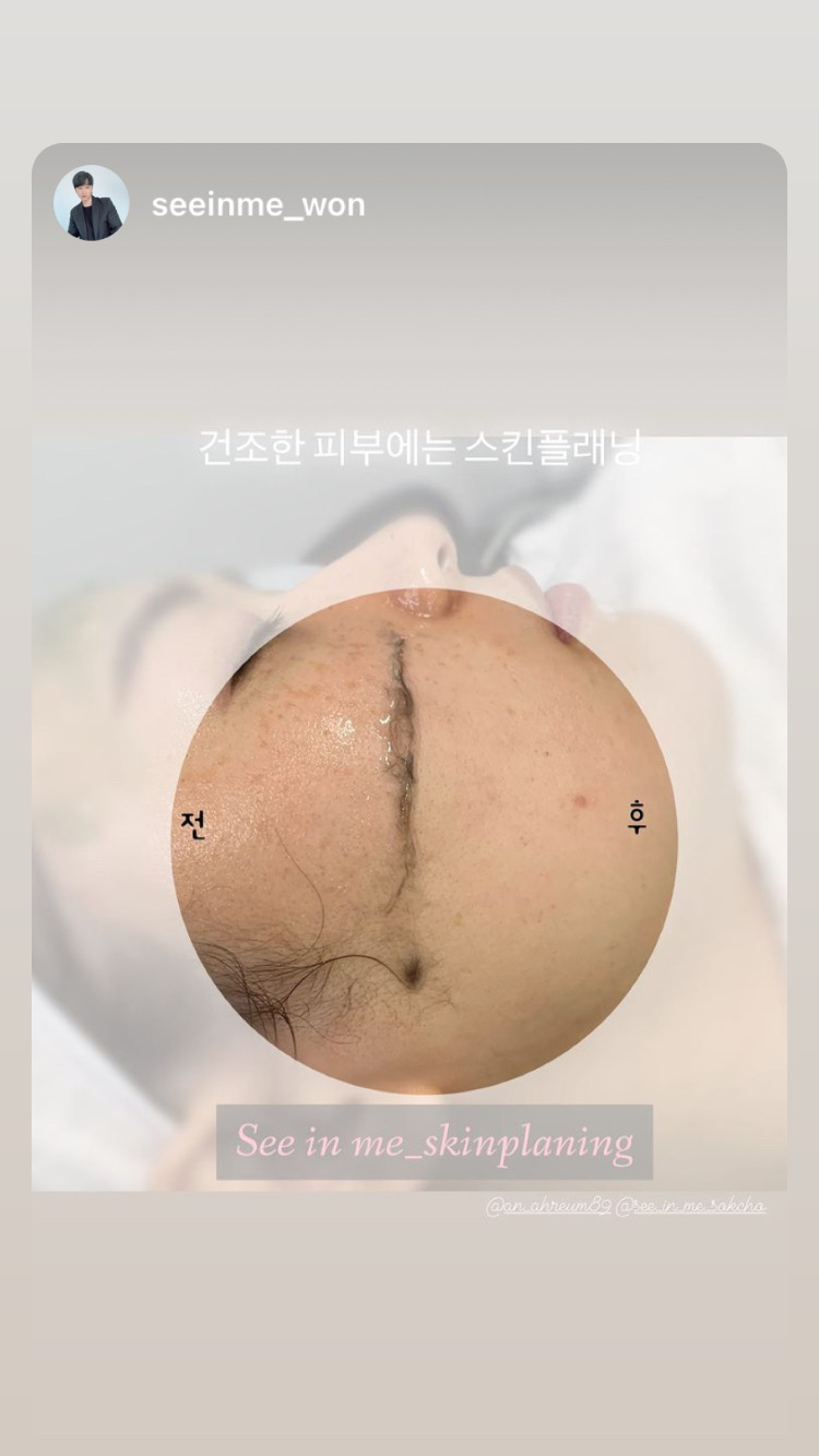 씨인미