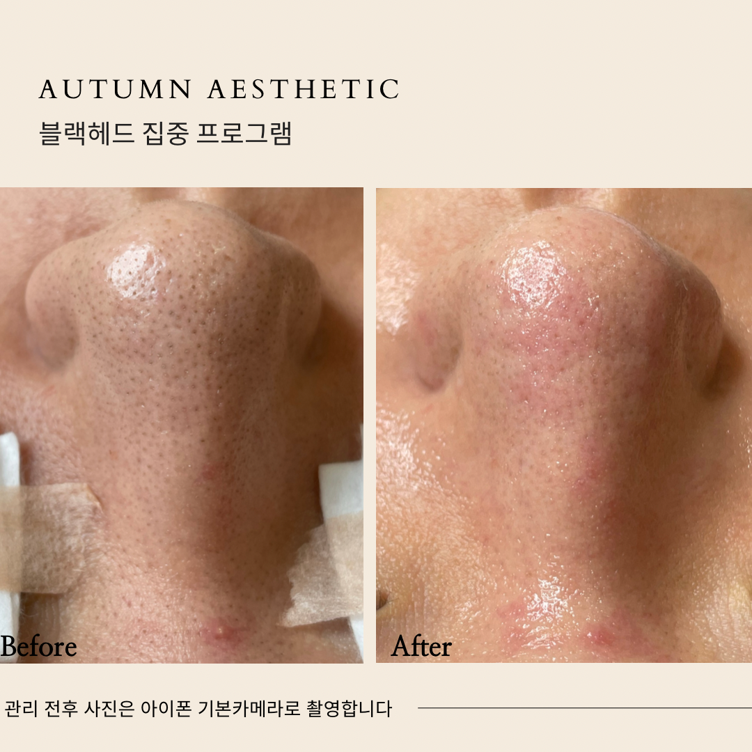 어텀에스테틱 안양범계점 대표 이미지