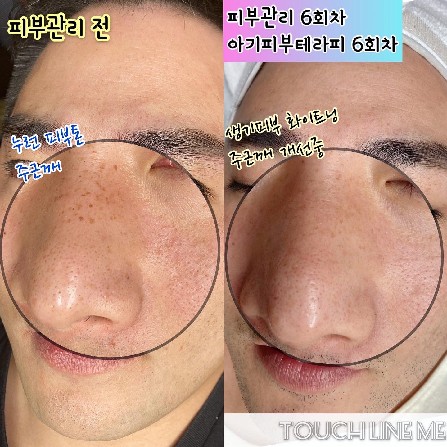 터치라인미