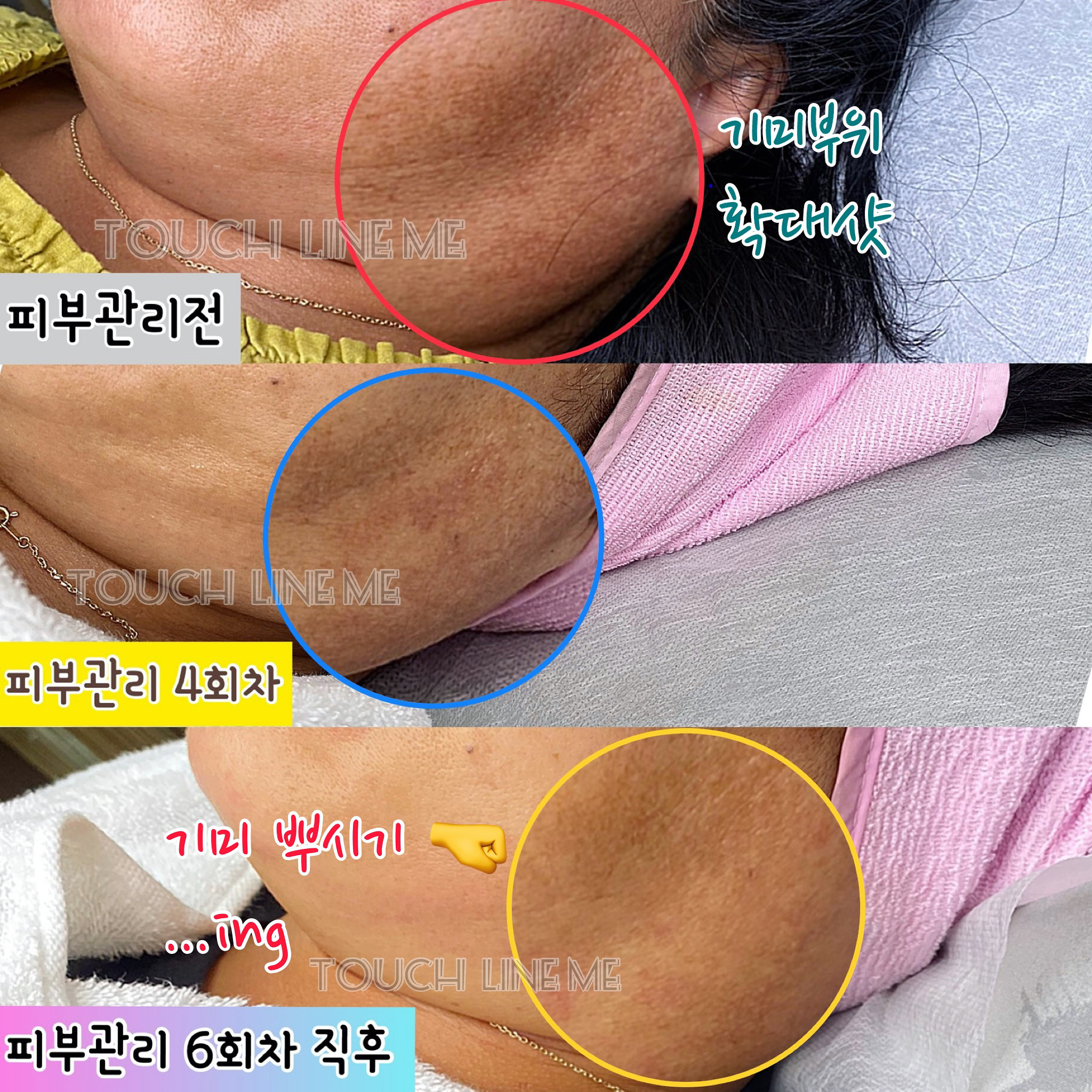 터치라인미