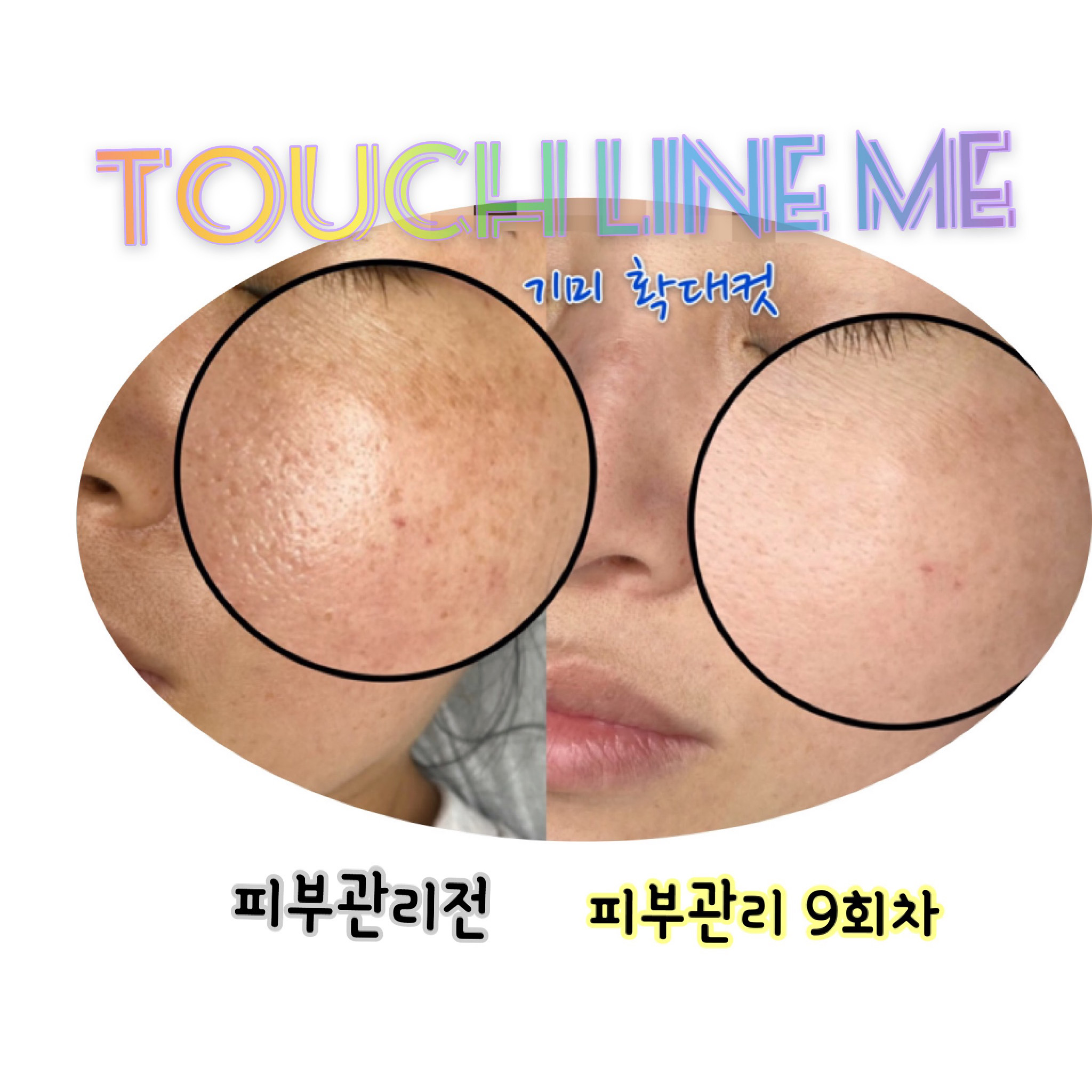 터치라인미